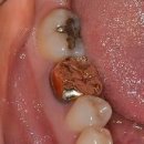 광안치과기공소 이미지