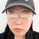 지구사랑 힐링 속으로 | 광주 상무지구 뷰티스에스테틱 피부관리후기