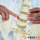 근력스트레칭 이미지