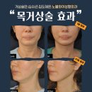 노블성형외과의원 이미지