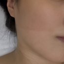 세븐일레븐 대전괴정힐링점 | 대전 에르벨에스테틱 뱀부 윤곽관리 잘하는곳 솔직 후기 +전후사진