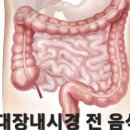 아후.. 위대장내시경~ 이미지