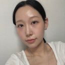 May 17 • 논현피부과의원 리쥬란 한달후기
