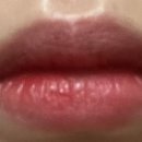 비티에프의원 이미지