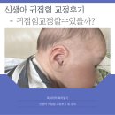 골든메디 | 육아 ｜신생아 귀접힘 교정 후기 (내돈내산 메디톡)
