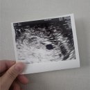 수정로171번길 | [임신일기] 임신 4주~5주차 병원 방문 후기 "금빛여성의원"