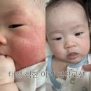 오투오 | 태열심한아기/신생아태열/쁘리마쥬/어네이브/아토팜판테놀/아토오겔 수딩젤/다 내돈내산 해본경험 후기