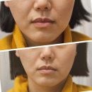석수약국 | 확실한 효과 안양에스테틱 : 숲칼프 안양석수점