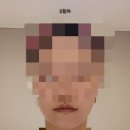 얼굴비대칭..내돈내산[가인미가 부천점] 7회차 후기 (feat.관리직후사진들)