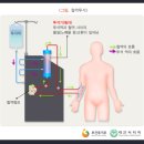 만성신부전증의 단계[만성콩팥병 3단계 중증도의 사구체 여과율 감소(30-59mL/분)] 이미지