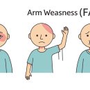 뇌졸중(중풍)FAST법칙, 골든타임 3시간 안에 해야 할 일 이미지