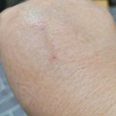 월영동261 | 경상남도 창원시 마산합포구 월영동 대상포진 전문병원 추천 | 무료접종 | 예방접종