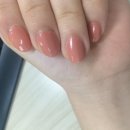 못난이 손톱