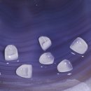 국치과기공소 이미지