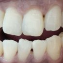 티파니치과의원 이미지