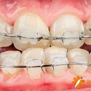 센스 치과의원 이미지