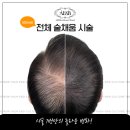 월앤비