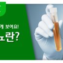 소아 혈뇨[childhood hematuria] 이미지