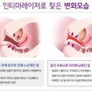 인티마