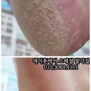 발건강관리사(2급) 이미지