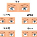 양재안경 이미지