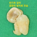 기쁜마음치과의원 이미지