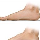 알즈너 점프 대리점 이미지