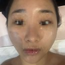 독립로L(4) | [ 광주 : 스킨케어 ] 백운동 피부관리 아띠랑스 스킨케어
