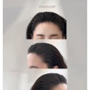 (주)헤브론 | 헤어라인SMP 화인에서 엠자 이마 콤플렉스 지우고 올백 번헤어 웨딩 촬영까지 완벽하게 소화해 낸 후기