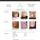 타임네일 페디베네 네이버블로그