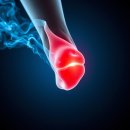 일구구팔 | 관절염과 산화질소 놀라운 변화를 이끄는 핵심 원리