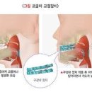 코골이 소리 원인 심할때 줄이는법 멈추는법 간단 정리 이미지