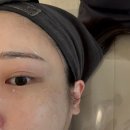 성성한의원 | 천안성성동 에스테틱 로미에스떼/휴가앞두고 뱃살,얼굴관리 왕추천후기