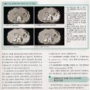 MRI와 CT는 어떻게 다른 것인가? 이미지