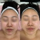 (주)케어사이드 | 대구리프팅 신부관리 잘하는 플라미뷰티 원대동 스킨케어 윤곽관리 솔직 후기