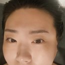 아리카스킨솔루션센터 | 성남피부관리 아리카스킨솔루션센터 셀폰테라피 후기