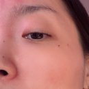 [W.👰🏻‍♀️] 5 - 대구 예신신부관리로 바디지방분해주사 맞고 온 썰 💉