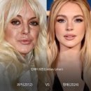 신논현성형외과 엘라비에리투오 키닥터 내돈내산 린제이로한이 받은 그 시술 효과 통증 다알려줌
