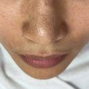 루다뷰티 - 김해시 진산대로26번길 14-9 | 일산여드름관리 잘하는 곳, 장항동피부관리 루다뷰티앤왁싱 후기