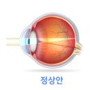 으뜸플러스안경서울아차산역점 이미지