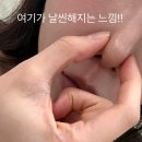 (주)한코교역 | 코조각주사 효과 언제부터? 한달 지나니 복코가 더 얄쌍해진 후기