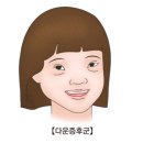 다운증후군 이미지