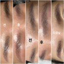 강이주는맛집 | 시흥 정왕동 눈썹문신제거 맛집 유리뷰티샵 1회차 후기