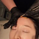 헤어라인 | 구월동왁싱 잘하는 솜왁싱 헤어라인 후기