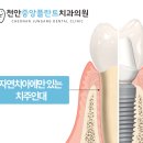 천안 과잉진료 없는 치과, 어떤 기준으로 선택해야 할까?