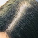 주식회사 블루메디 | 탈모샴푸추천 블루메디 효장생 탈모 샴푸