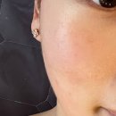 💆🏻‍♀️ 원주 리율에스테틱 | 원주 피부관리 | 리율에스테틱 후기