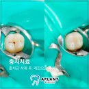 에이플란트치과의원 이미지