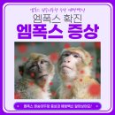 엠폭스 원숭이두창 증상 엠폭스 확진환자 <b>국내</b><b>발생</b><b>현황</b> 백신 예방수칙 알아보아요