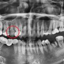 크라운치과의원 이미지